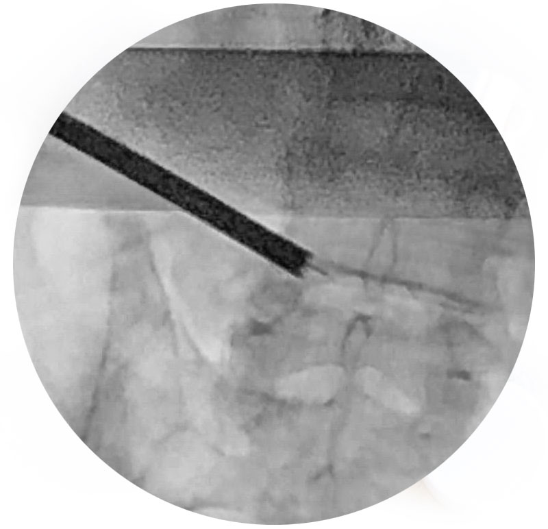 DR-MIGUEL-ANGEL-RODRIGUEZ-ENDOSCOPIA-COLUMNA